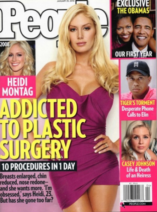heidi montag plastic surgery before and after people. heidi montag