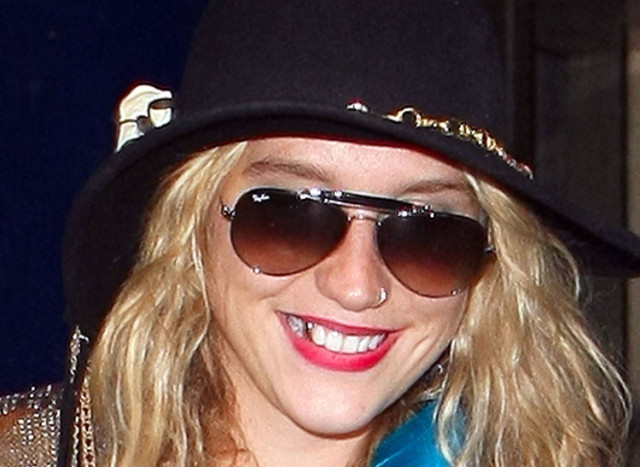 Kesha got a gold tooth | The Blemish