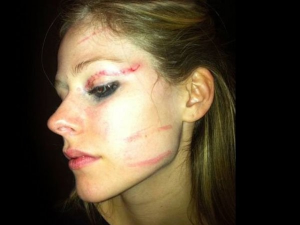 avril lavigne beat up. Supposedly, this is what Avril Lavigne's face looked like after she and her 